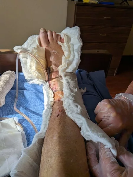 current-anklec.jpg